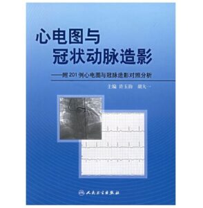 《心电图与冠状动脉造影》PDF电子版免费下载-医学电子书