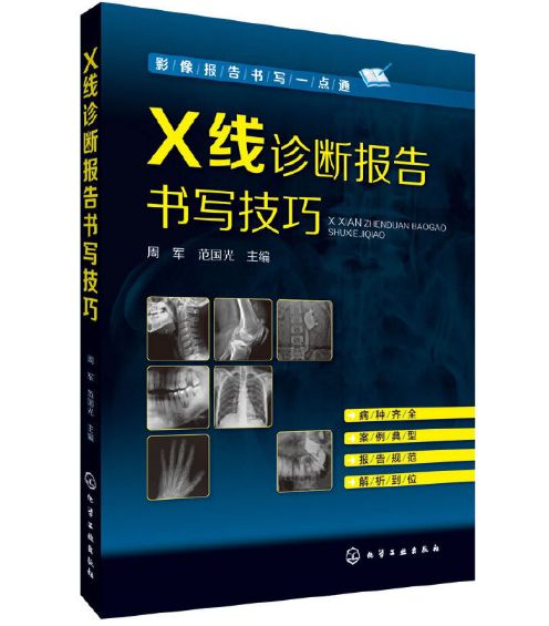 影像报告书写一点通《X线诊断报告书写技巧》周军主编.PDF电子版免费下载