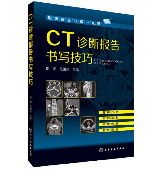 影像报告书写一点通《CT诊断报告书写技巧》周军主编.PDF电子版免费下载