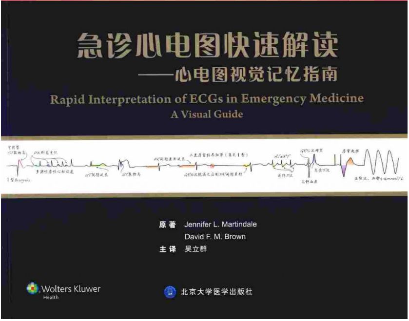 《急诊心电图快速解读—心电图视觉记忆指南》吴立群主译.PDF电子版免费下载
